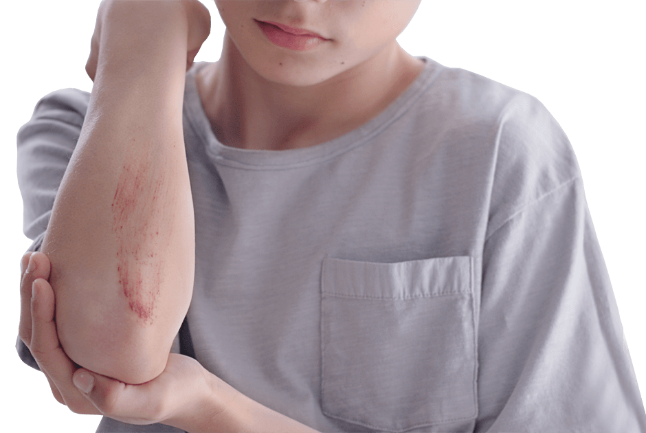 Neoviderm  Para el cuidado de la piel dañada